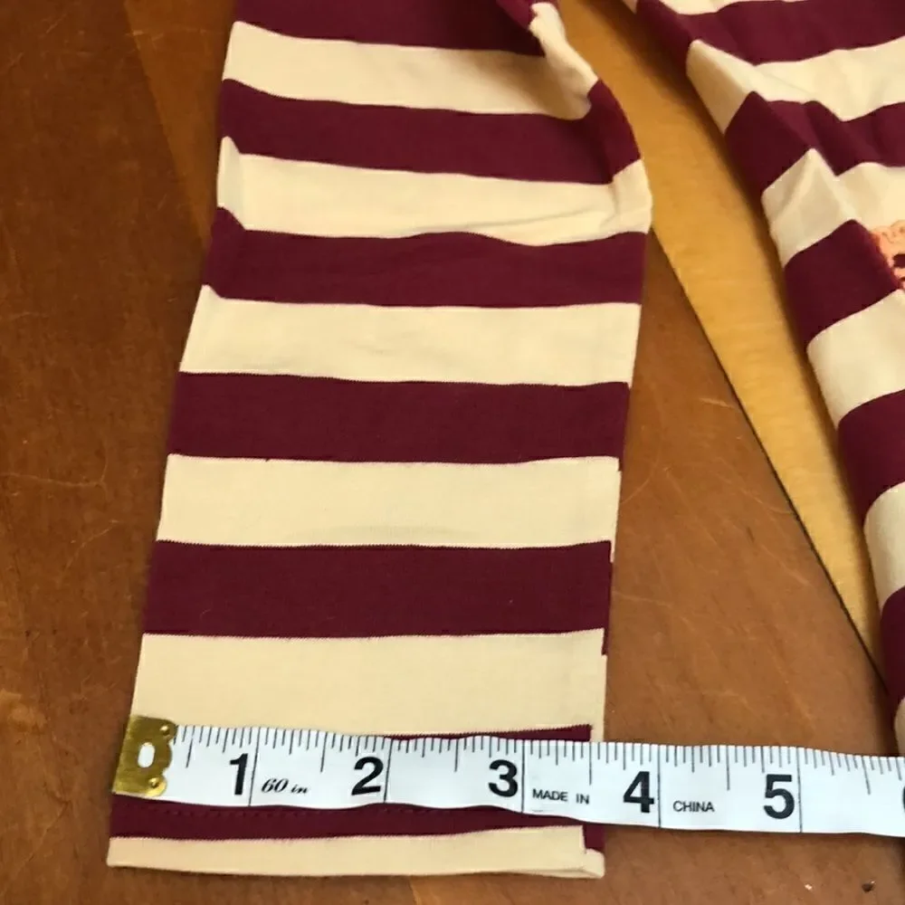Fancaiwindmill girl's striped dress